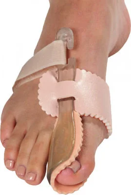 ΝΑΡΘΗΚΑΣ ΜΕΓΑΛΟΥ ΔΑΧΤΥΛΟΥ HALLUX VALQUS
